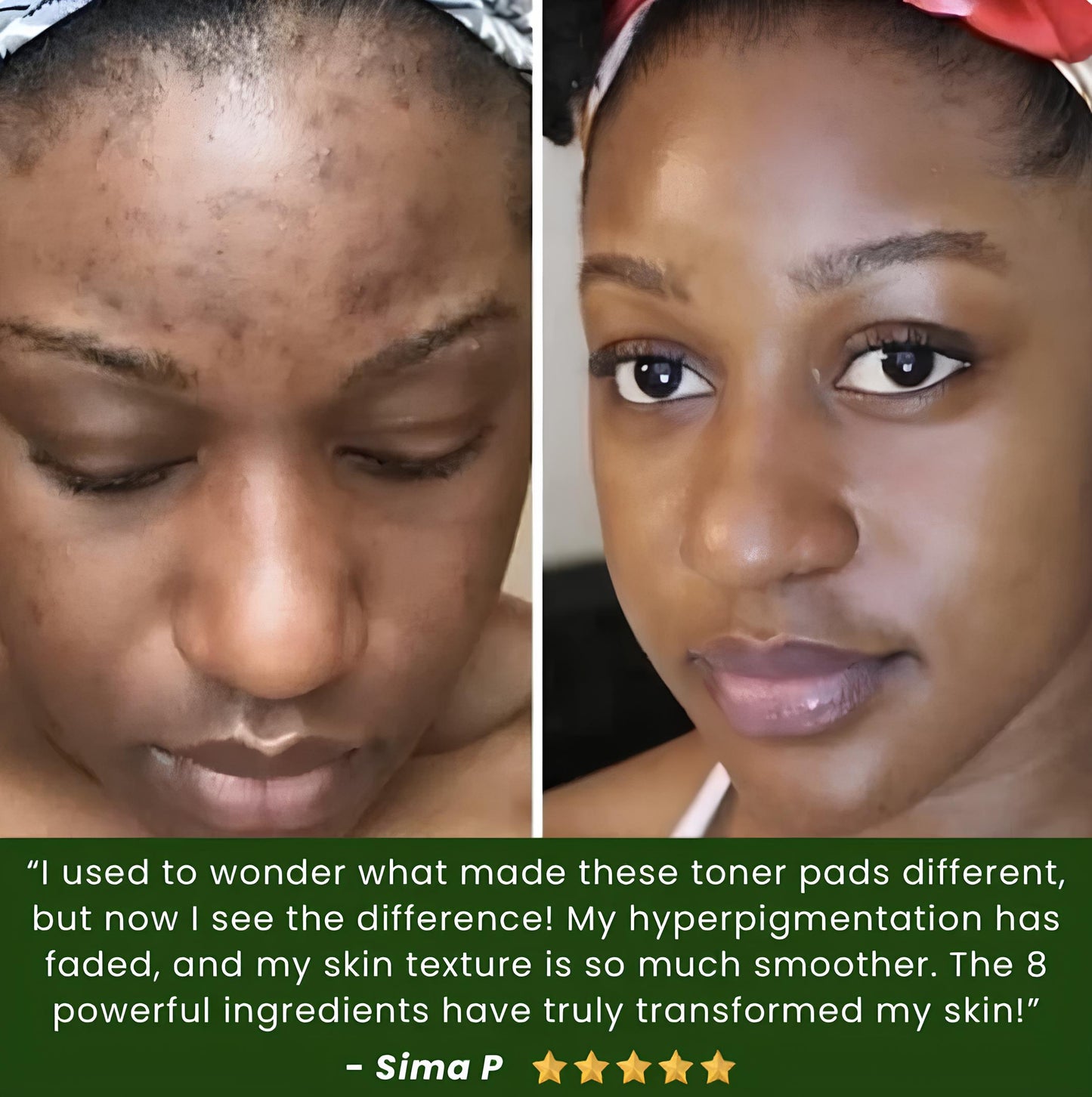 Jiyu Glass Skin Toner Pads